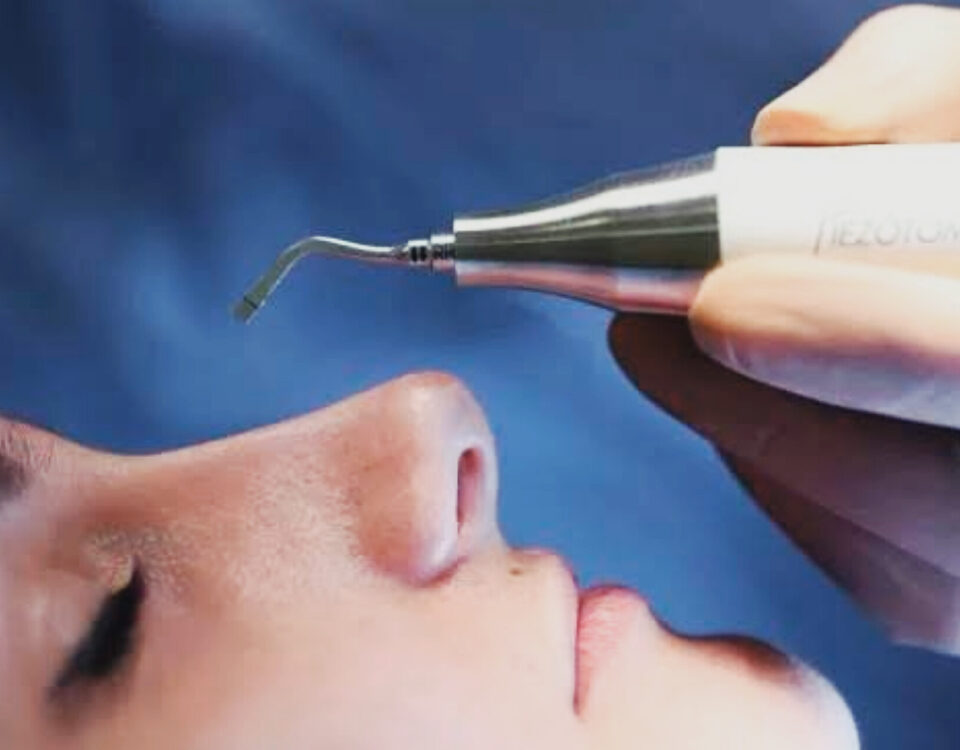 What Are the Latest Advances In Rhinoplasty