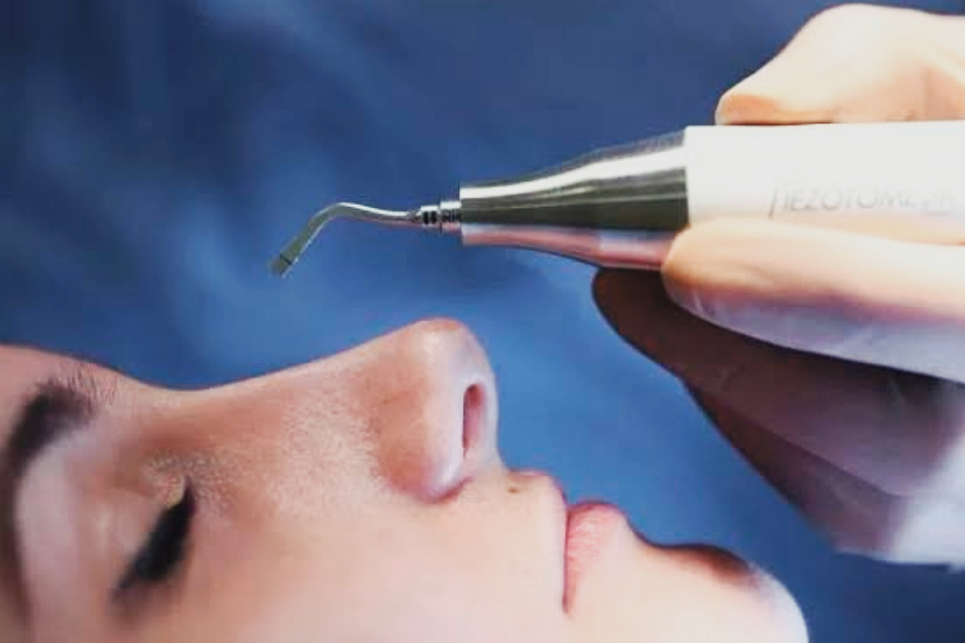 What Is The Most Difficult Rhinoplasty what-is-the-most-difficult-rhinoplasty